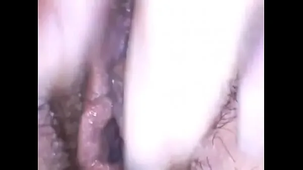 XXX Exploring a beautiful hairy pussy with medical endoscope have fun Filem hebat